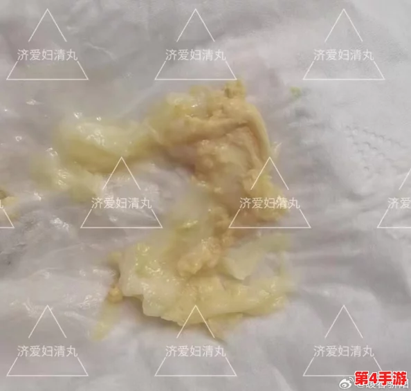 胡桃尿道口流出白色脓状物是什么?用户评论称可能是感染,建议及时就医! 胡桃尿道口流出白色脓状物是什么?用户评论称可能是感染,建议及时就医!