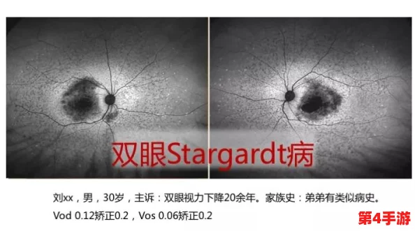 超级胬肉系统第二部叫什么?一触即发,久久难忘 超级胬肉系统第二部叫什么?一触即发,久久难忘