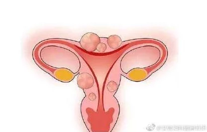 睾丸进入子宫的里面长肉粒正常吗？专家解读生殖健康与异常现象的关系