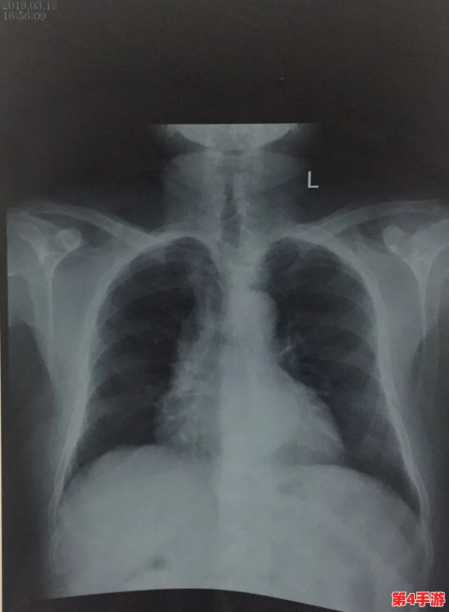 胸片全体曝光：揭示医疗影像背后的隐秘故事与患者健康的真实状况，值得每个人关注和思考